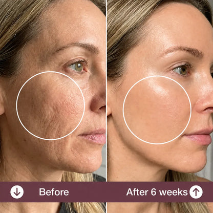 Bluvea™ Anti-Wrinkle Pillow